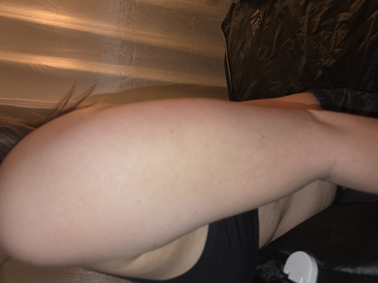Arm Sculpting before treatment
